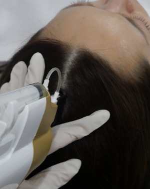 スカルプケア施術